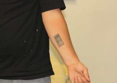 Black Barcode Tattoo on Forearm Before Laser
