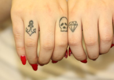 Black Finger Tattoos before laser removal