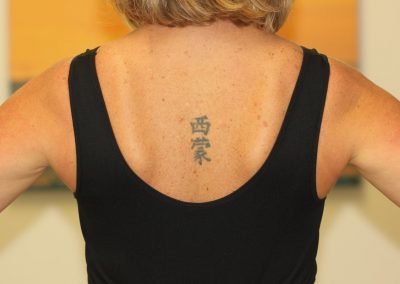 Black Japanese back tattoo before laser tattoo removal