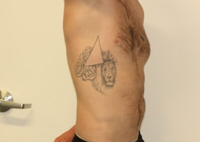 Black Lion Tattoo on Ribs Before