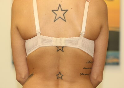 Black Star Tattoos on Spine Before