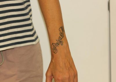 Black Wrist Name Tattoos Before Laser Tattoo Removal 1