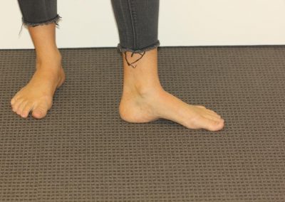 Black and Red Ankle Tattoo After Laser