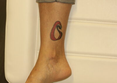 Black and Red Ankle Tattoo Before