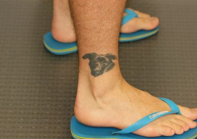 Black ankle dog tattoo before laser tattoo removal