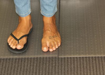 Black foot tattoo before laser tattoo removal