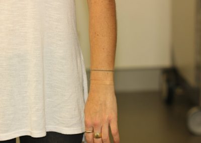 Black line wrist tattoo before laser tattoo removal