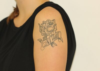 Black shoulder rose tattoo before laser tattoo removal