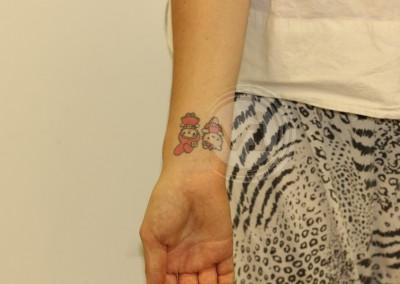 Pink and black wrist tattoo before treatment