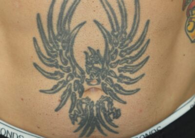 Dark Black Phoenix Tattoo on Belly Before Compressed