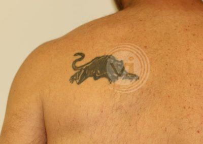 Dark black panther back tattoo before laser