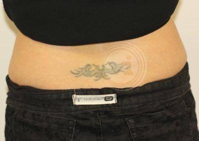 Lower Back Small Tribal Tattoo Before Laser