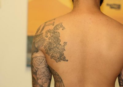 Black Back Tattoo Before Laser