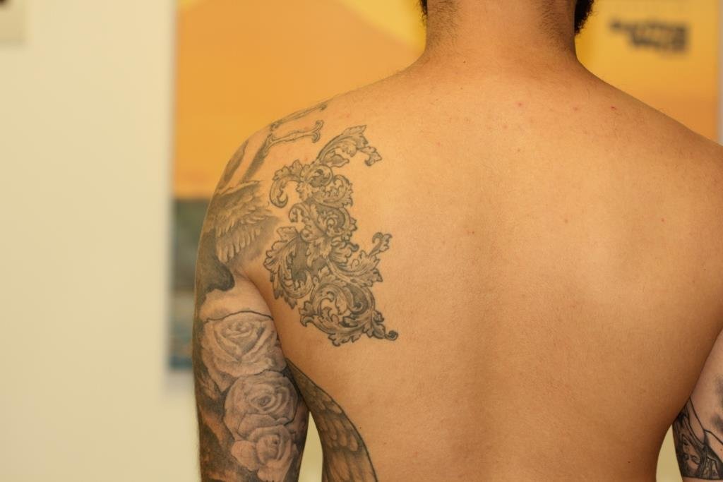 How does laser tattoo removal work? | Goodbye Tattoos