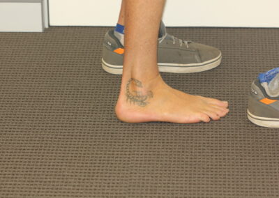 Black Scorpion Tattoo on Ankle Before