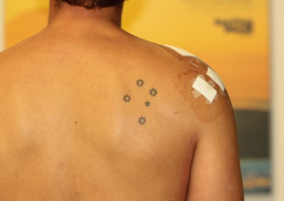 Black Southern Cross Tattoo After Laser Tattoo Removal