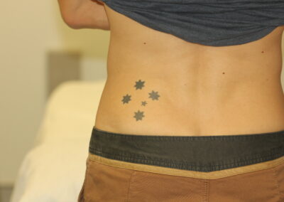 Black Southern Cross Tattoo on Hip Before