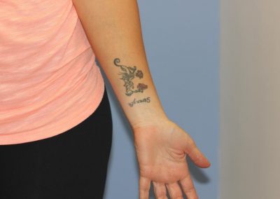 Black Wrist Text Tattoo Before Laser