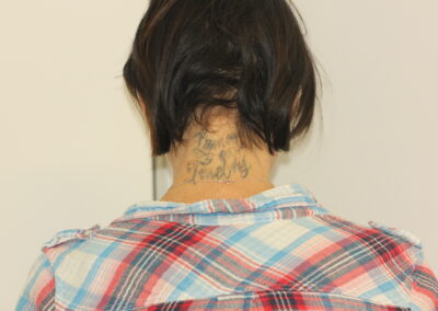 Blue Neck Tattoo Before