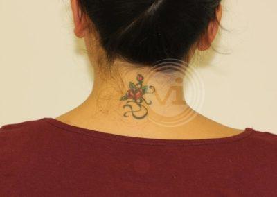 Flower Tattoo on Neck before removal