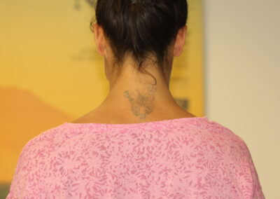 Coloured Butterfly Tattoo Residual on Neck Before
