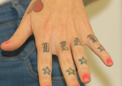 Coloured Finger Tattoos LHS Before Laser