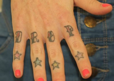Coloured Finger Tattoos RHS Before Laser