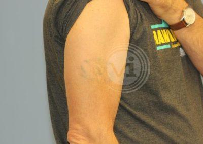 Coloured puma tattoo after laser fade