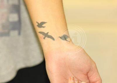 Female Wrist Tattoo Before