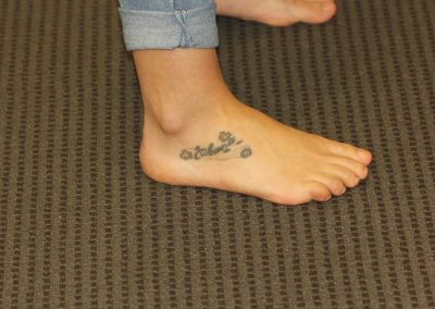 Coloured Foot Tattoo Before Laser