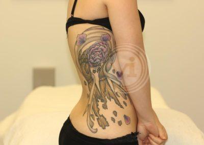 Large coloured rib tattoo before laser