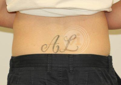 lower-back-tattoo before removal