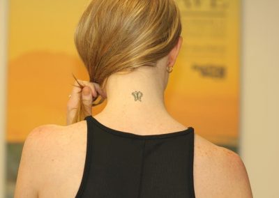 Neck Butterfly Tattoo Before Tattoo Removal