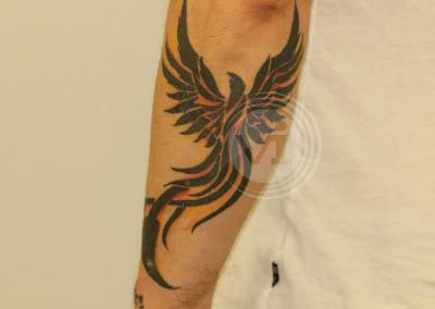 Very dark forearm tattoo before treatment