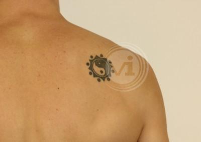 Black Ying Yang shoulder tattoo before laser removal